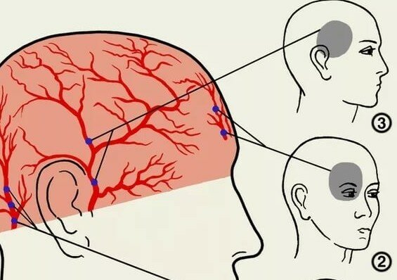 каждый день болит голова глаза