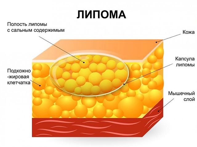 Выскочила шишка на спине болит