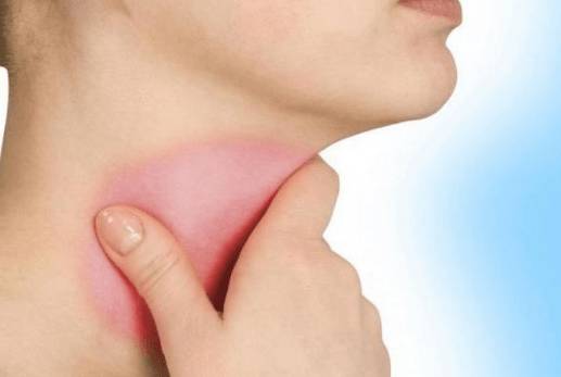 Жутко болит голова и горло