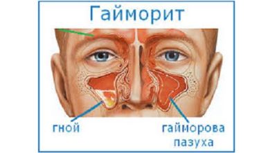 Почему упадок сил голова болит