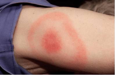 Почему упадок сил голова болит