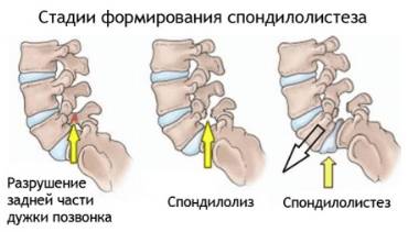 Не могу спать болит спина в грудном отделе