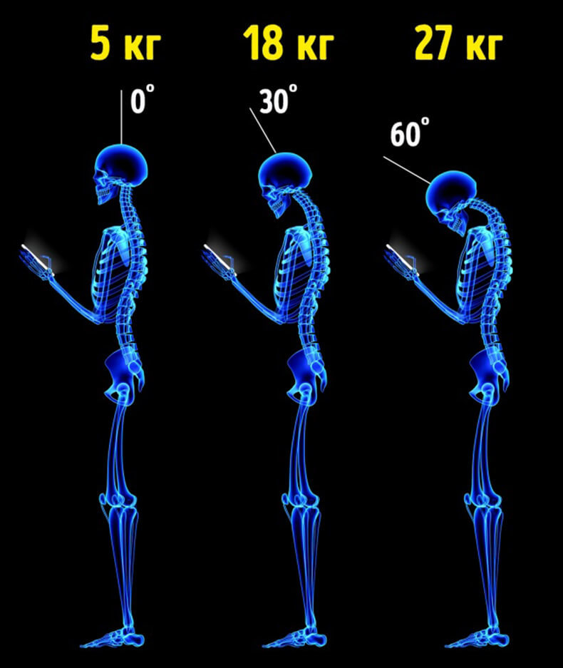 БОЛИТ ПОЗВОНОЧНИК? ПРОВЕРЬТЕ ЗУБЫ! БОЛИТ ПОЗВОНОЧНИК? ПРОВЕРЬТЕ ЗУБЫ!