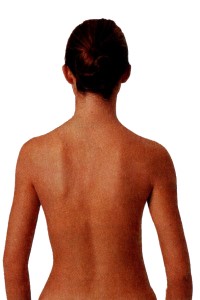 Мышечный дисбаланс