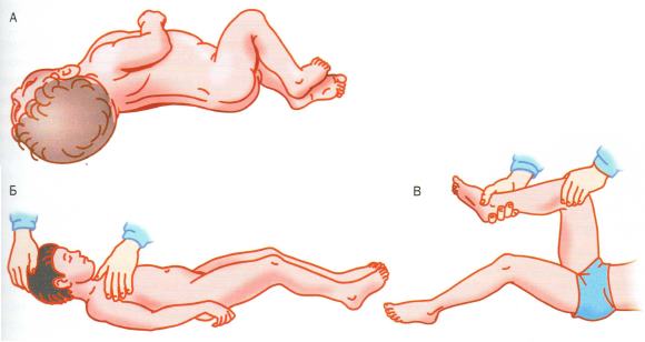 Симптомы менингита