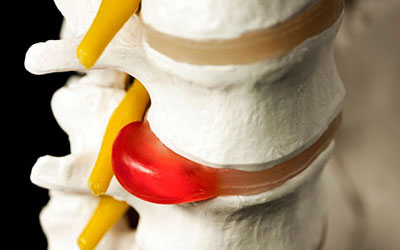 болит голова шея и левая рука