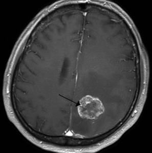 Почему упадок сил голова болит