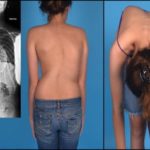 болит в правой части грудной клетки отдает в спину